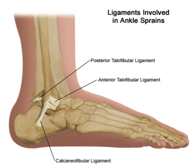 sprained ankle basketball treatment